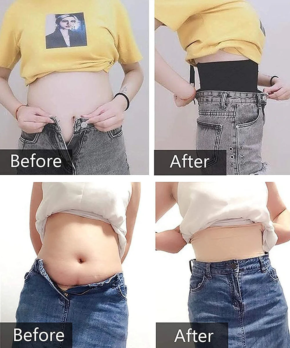 TummyTucker™