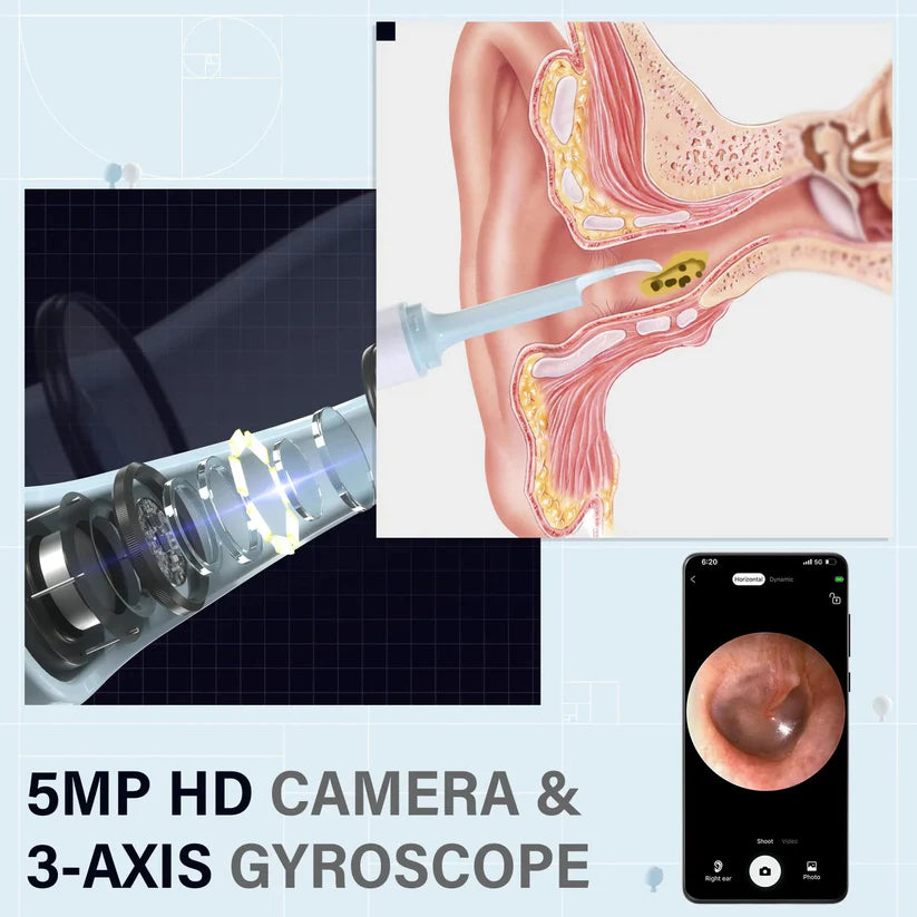 EarCareBuddy™ | SmartCleaner